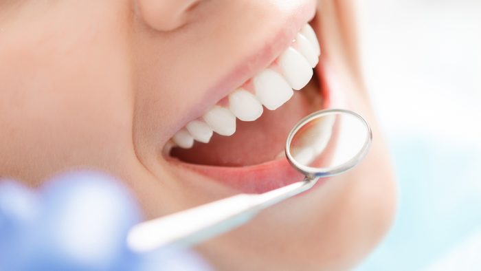 Advantages of Teeth Whitening | THDC
